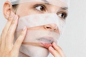 Mädchen in Bandagen nach Nasenkorrektur